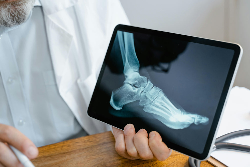 Best Strategies and Supplements for Bone Health and Reducing the Risk of Osteoporosis